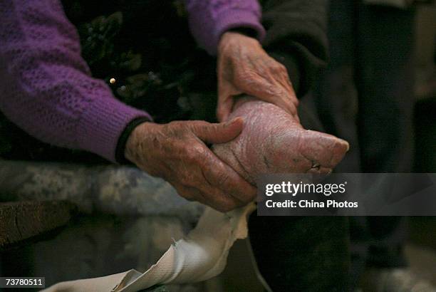 Year-old bound feet woman, whose surname is Luo Pu, displays her bound foot in her home, at Liuyi Village on April 3, 2007 in Tonghai County of...