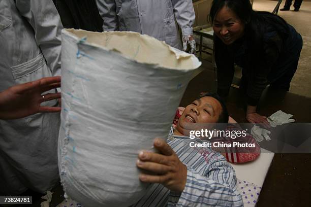 Chinese man Peng Shuilin, whose body was severed in half in a traffic accident, views the artificial abdominal cavity made by experts of China...