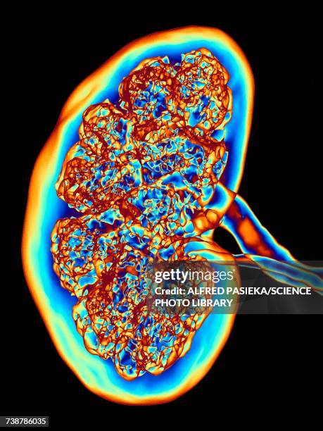 kidney, ct scan - tomography stock pictures, royalty-free photos & images