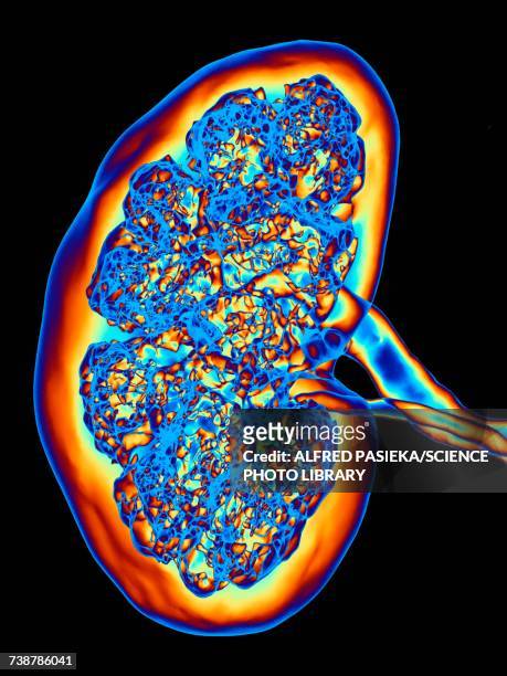 kidney, ct scan - human kidney stock-fotos und bilder