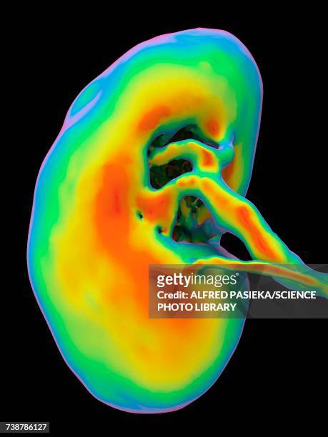 kidney, ct scan - human kidney stock-fotos und bilder