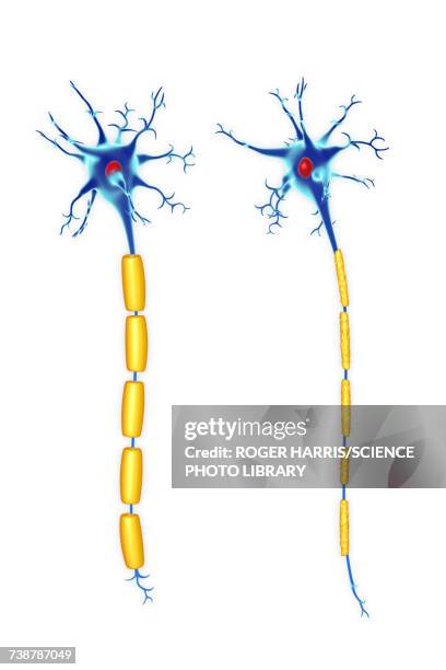 stockillustraties, clipart, cartoons en iconen met nerve cells, illustration - multiple sclerose