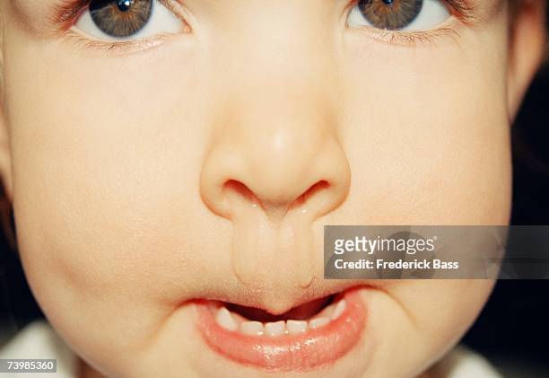 child with a runny nose - mucus stock pictures, royalty-free photos & images