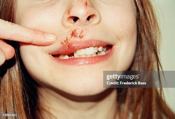 young girl with a scratched face - schadenfreude stock-fotos und bilder