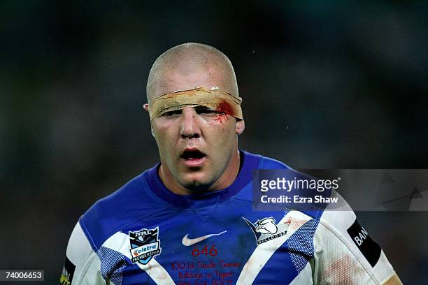 Mark O'Meley of the Bulldogs walks off the field after being taken out of the game against Tigers during the round seven NRL match between the...