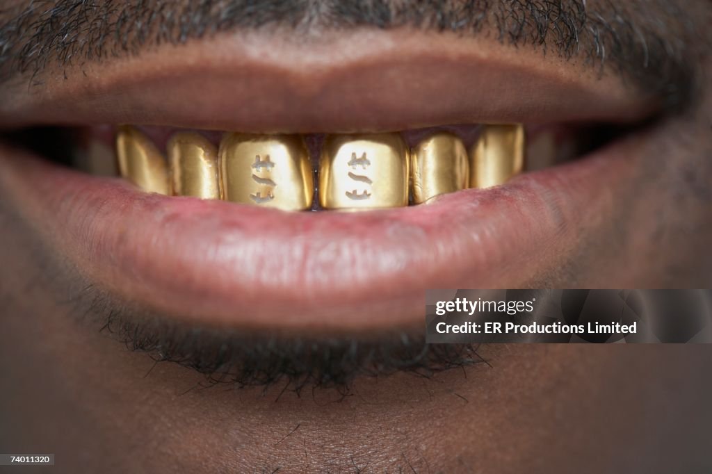 Close up of African man with gold teeth