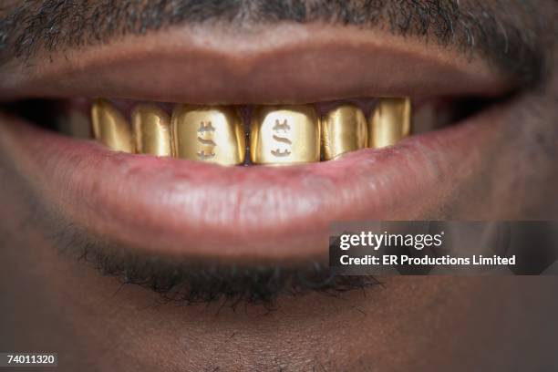 close up of african man with gold teeth - millionnaire stockfoto's en -beelden