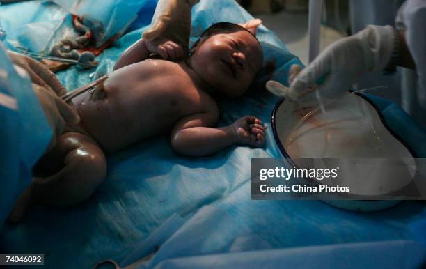 Doctor cuts the umbilical cord of the newborn baby of Muslim woman Yang Xiaoxia, at the Obstetrics and Gynecology Department of Xining Children...