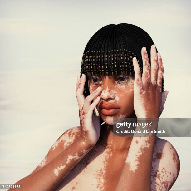 woman with vitiligo - vitiligo stock pictures, royalty-free photos & images