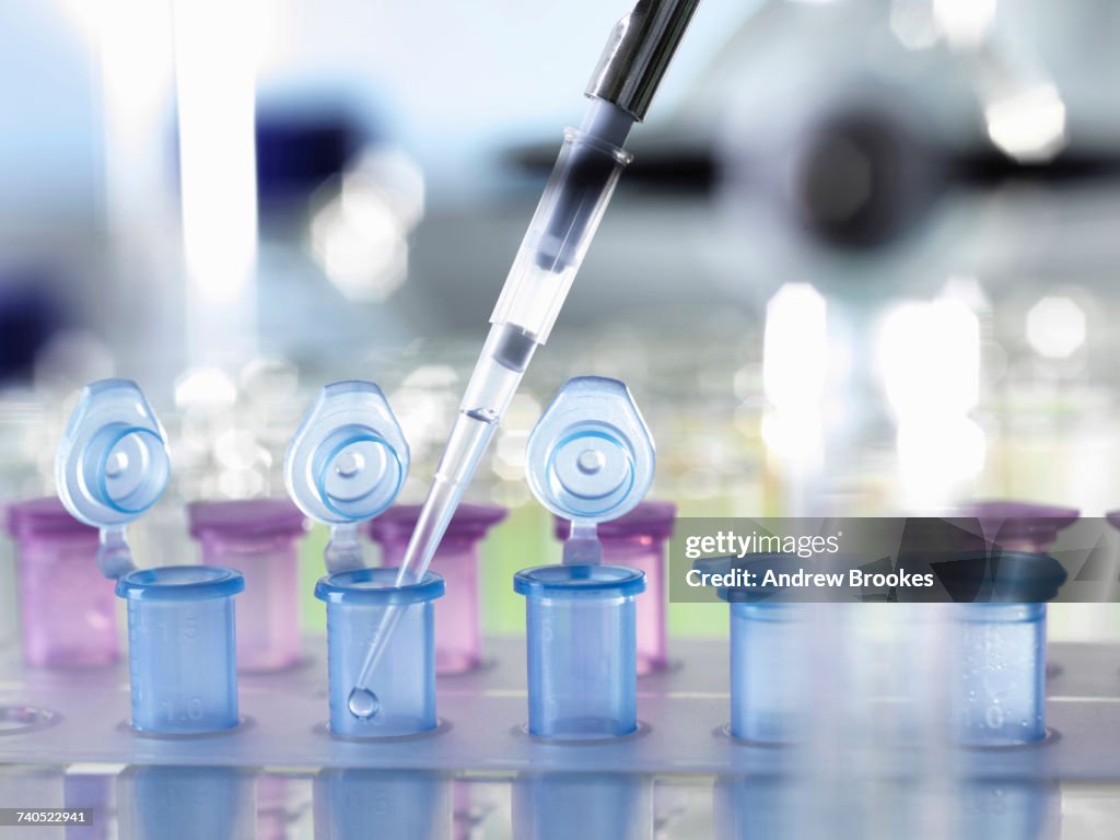 Pipetting Sample Into Vial For Testing In The Laboratory High-Res Stock ...