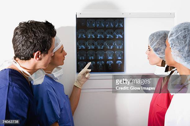 side profile of a male surgeon and three female surgeons looking at a mri scan - surgical mask profile stock pictures, royalty-free photos & images