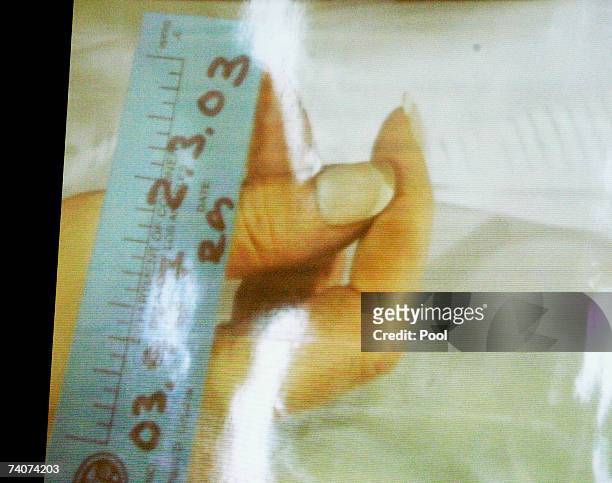 Photograph of the fingers of Lana Clarkson, taken after her death, is projected on a screen during a hearing during a hearing at Los Angeles Superior...