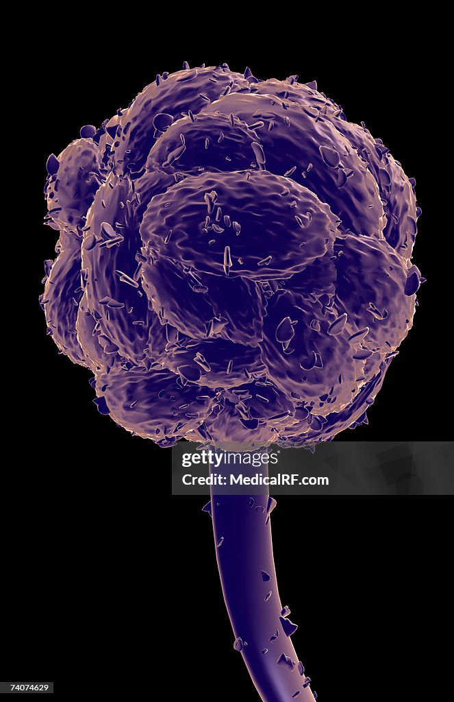 Stachybotrys Musae Stachybotrys Chartarum High-Res Vector Graphic - Getty Images