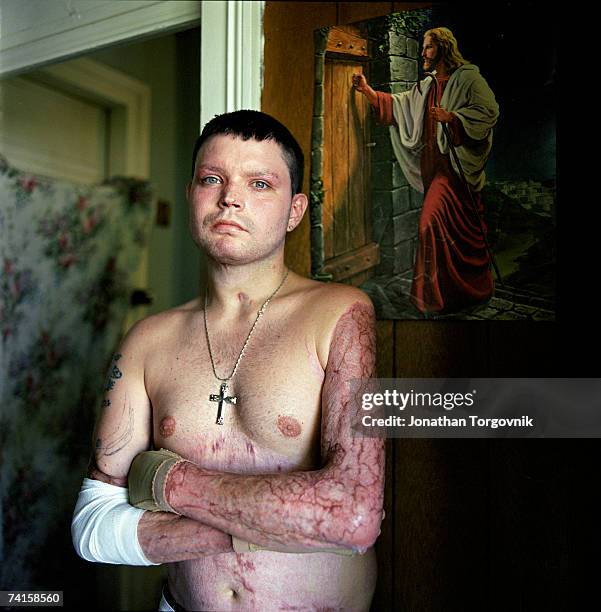 Ricky poses at his parents house where he lives on December 2, 2005 in Bowling Green, Kentucky. Ricky has been a Meth user for several years and was...