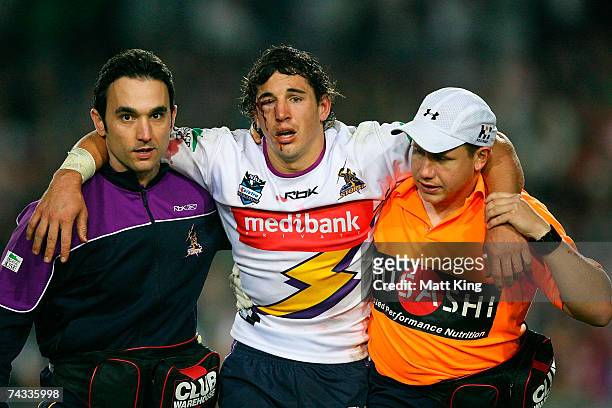 Billy Slater of the Storm is carries off the field with an eye injury during the round 11 NRL match between the Manly Warringah Sea Eagles and the...