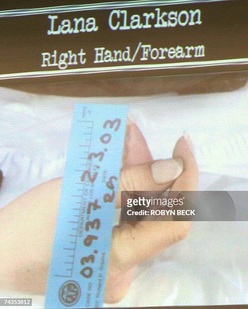 Los Angeles, UNITED STATES: A photograph showing the right hand of actress Lana Clarkson after her death is dislayed in court by the prosecution...