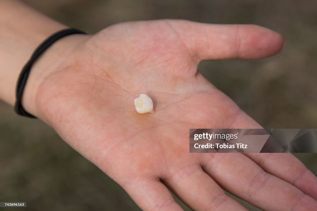 High angle view of hand showing tooth