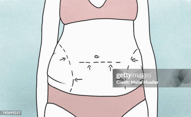 midsection of woman with marked outlines on abdomen - dessous stock-grafiken, -clipart, -cartoons und -symbole