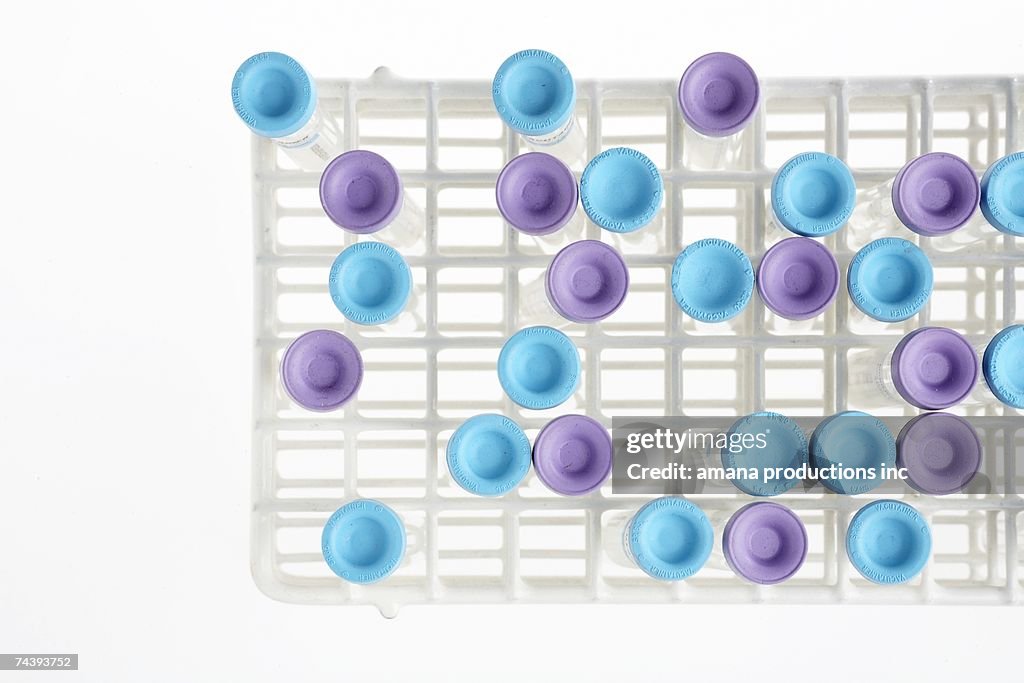 Test tubes in rack (directly above)