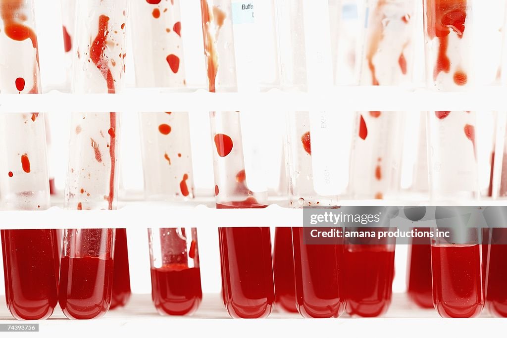 Blood samples in test tubes (close-up)