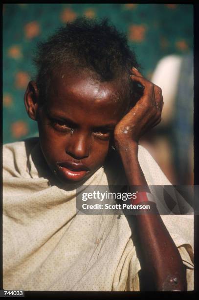 Ibrahim Ali Mohammed poses December 15, 1992 in Baidoa, Somalia. Somalia fell into anarchy after the fall of Siad Barre's twenty-two year rule and...