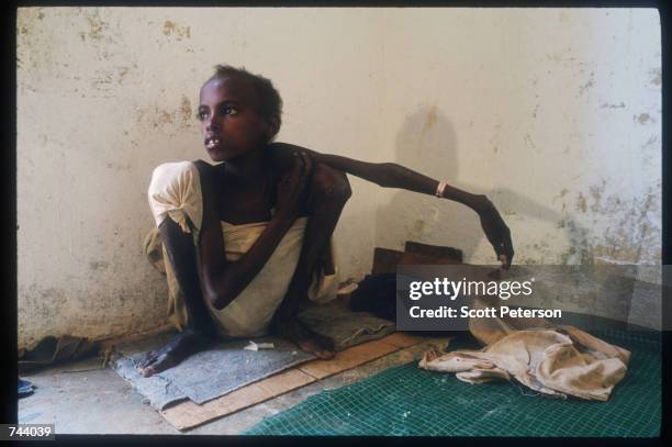 Ibrahim Ali Mohammed recuperates at Isha shelter December 15, 1992 in Baidoa, Somalia. Somalia fell into anarchy after the fall of Siad Barre's...