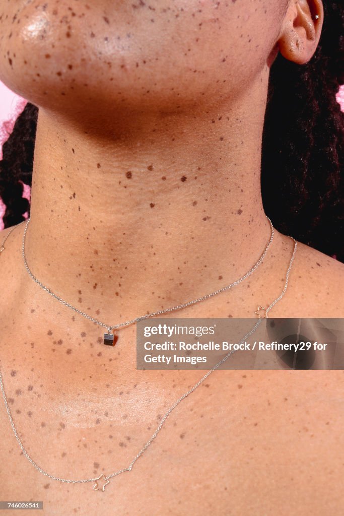 Portrait of a Young Womans Neck with Freckles