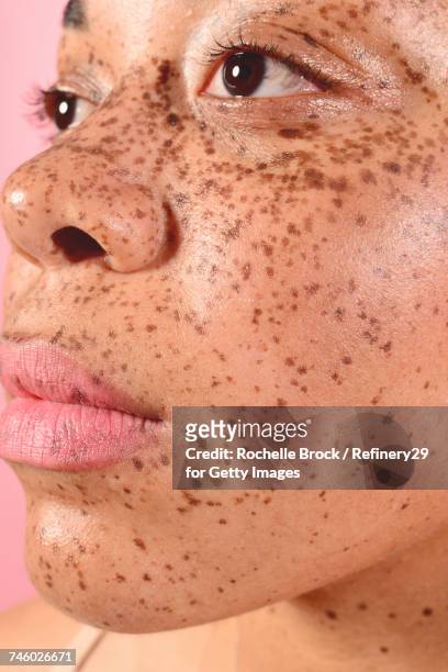 Beauty Portrait of Young Confident Woman with Freckles