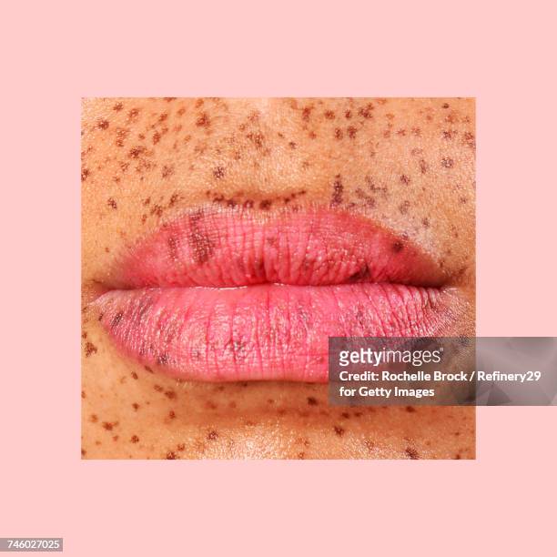 portrait of lips with freckles - sommersprossen stock-fotos und bilder