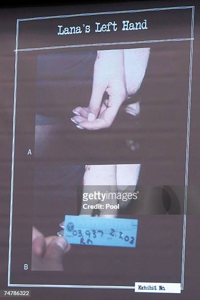 Projected crime scene evidence photos are displayed of Lana Clarkson's left hand during the murder trial of music producer Phil Spector at the Los...