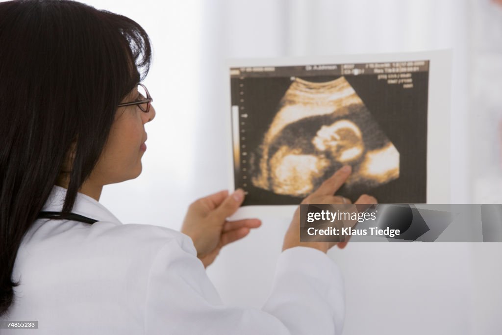 Female doctor looking at sonogram