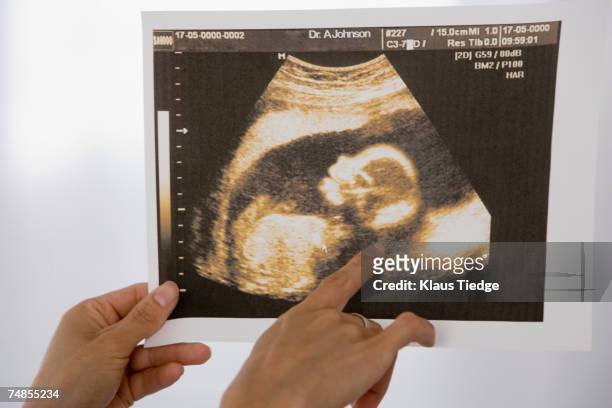 woman pointing at sonogram - foetus stock pictures, royalty-free photos & images