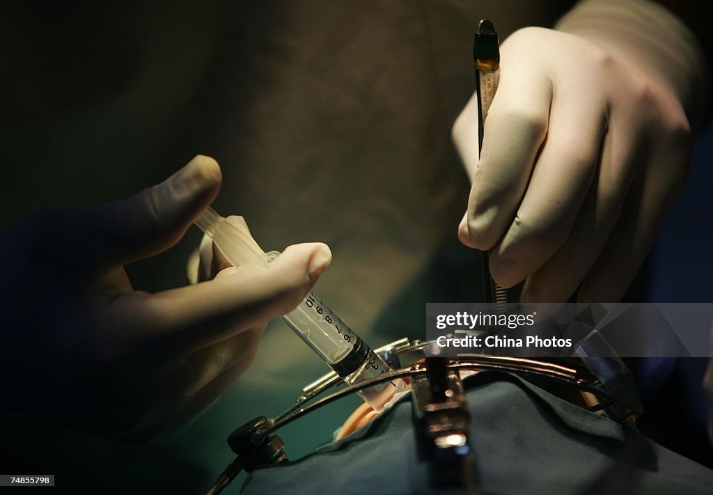 Group Works To Correct Cleft, Palate Cleft In Xian