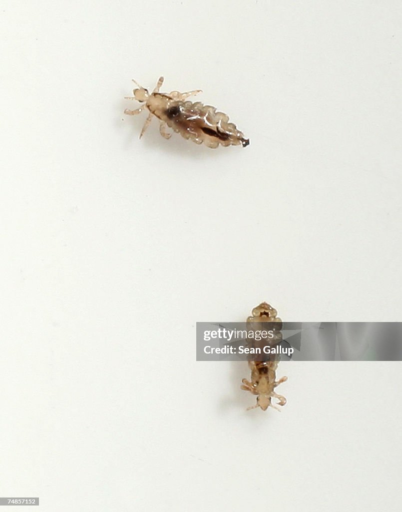 Common Head Lice