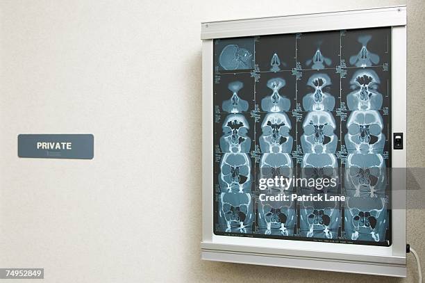 x-rays displayed on a light box - panel de luz fotografías e imágenes de stock