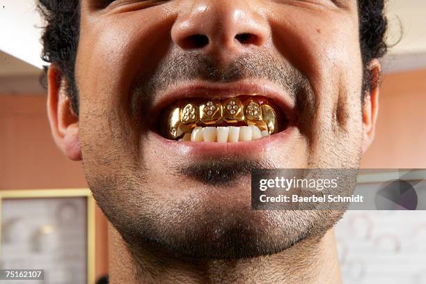 close-up of man with gold teeth - capped tooth stock-fotos und bilder
