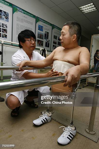 Peng Shuilin learns to walk as his doctor assists at the China Rehabilitation Research Center on July 6, 2007 in Beijing, China. 49-year-old Peng is...