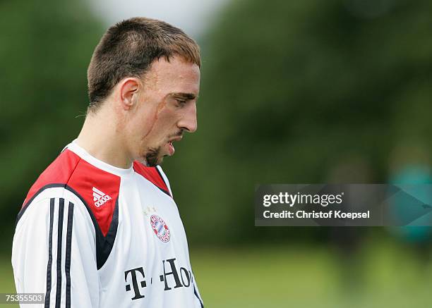 Franck Riber looks thoughtful during the training session at the training camp of Bayern Munich on July 10, 2007 in Donaueschingen, Germany.