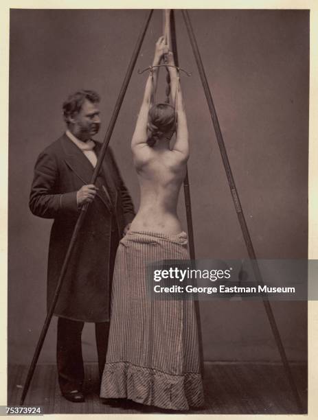 American orthopedic surgeon Lewis Albert Sayre supervises the suspension of a female patient as part of a treatment for spinal disease, New York, New...