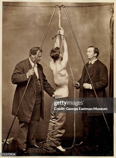 American orthopedic surgeon Lewis Albert Sayre supervises the suspension of a male patient, with help from another unidentified man, as part of a...