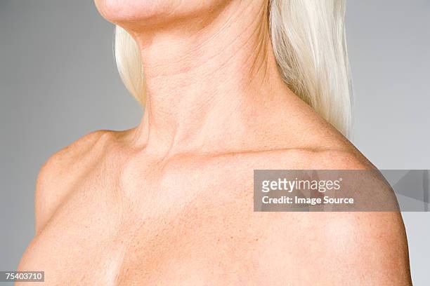 female chest and shoulders - lentigo stockfoto's en -beelden