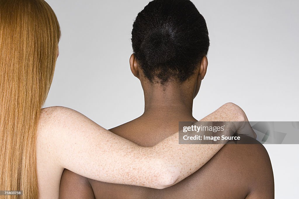 Woman with arm around friend