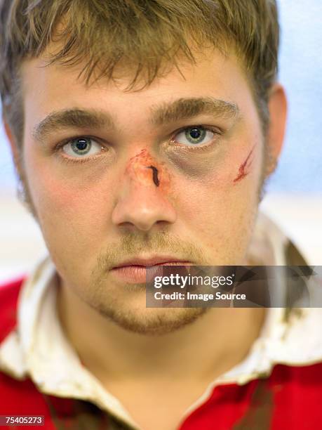 bruised and cut rugby player - head wound stock pictures, royalty-free photos & images
