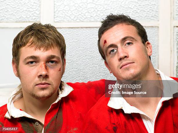 bruised rugby players - rugby players in changing room 個照片及圖片檔