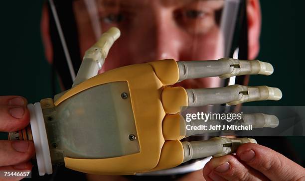 Stuart Hill project manager at Touch Bionics holds the highly functional bionic i-Limb hand on July 17,2007. The hand which has been tested by...