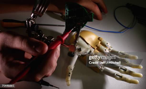 Stuart Hill project manager at Touch Bionics holds the highly functional bionic i-Limb hand July 17,2007. The hand which has been tested by amputees,...