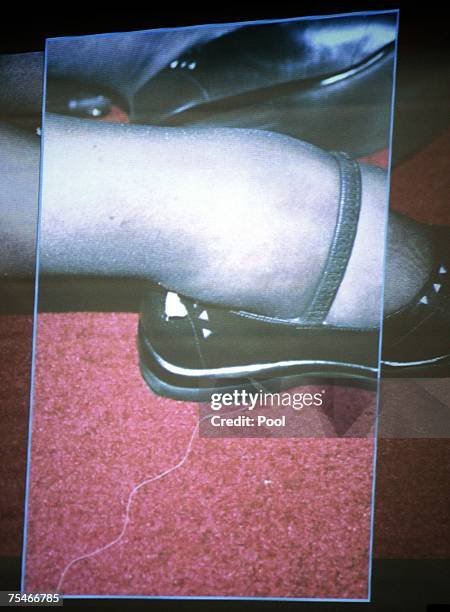 Photograph of actress Lana Clarkson's ankle after her shooting death is projected at Phil Spector's murder trial in Superior Court July 18, 2007 in...