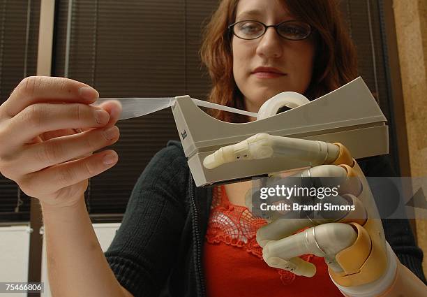 Lindsay Block, who was born missing the lower part of her left arm, demonstrates her new i-LIMB hand, described by its manufacturer as the first...