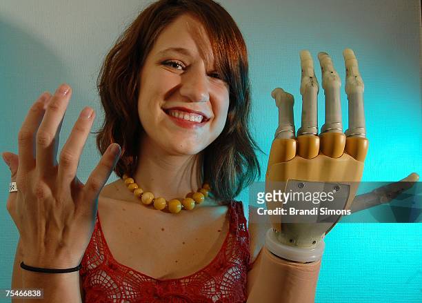 Lindsay Block, who was born missing the lower part of her left arm, demonstrates her new i-LIMB hand, described by its manufacturer as the first...