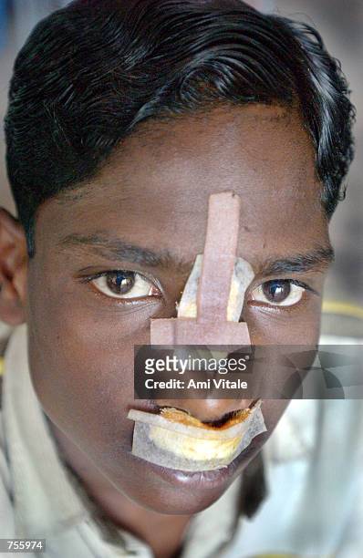 Abdul Kadar who was injured after an attack on his home sits inside a mosque March 5, 2002 in central Ahmadabad, India. Over 5000 Muslims have taken...